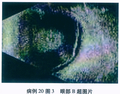 GJZC71_108_1.gif